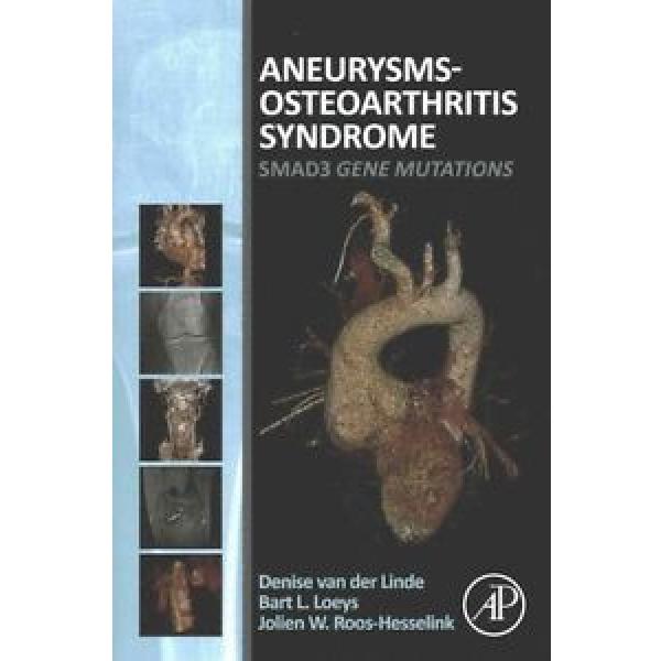 Aneurysms-Osteoarthritis Syndrome by Denise Van der Linde Paperback Book #1 image